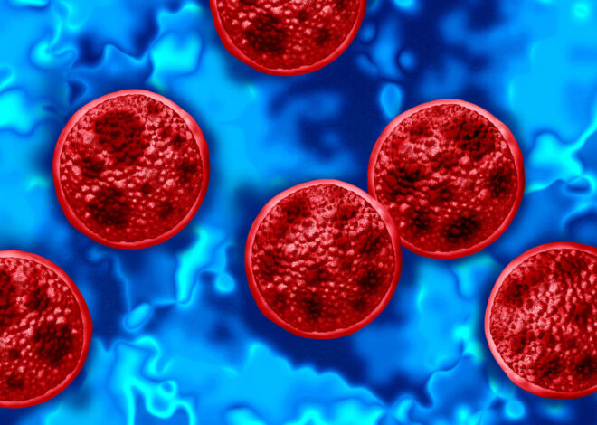 Michigan confirms first two deaths in cyclospora outbreak