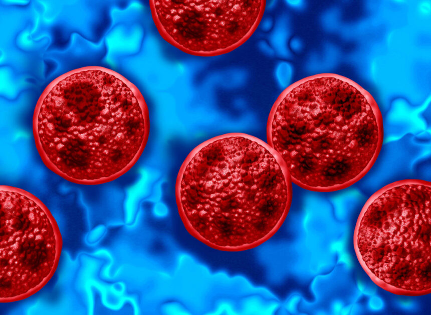 Michigan confirms first two deaths in cyclospora outbreak