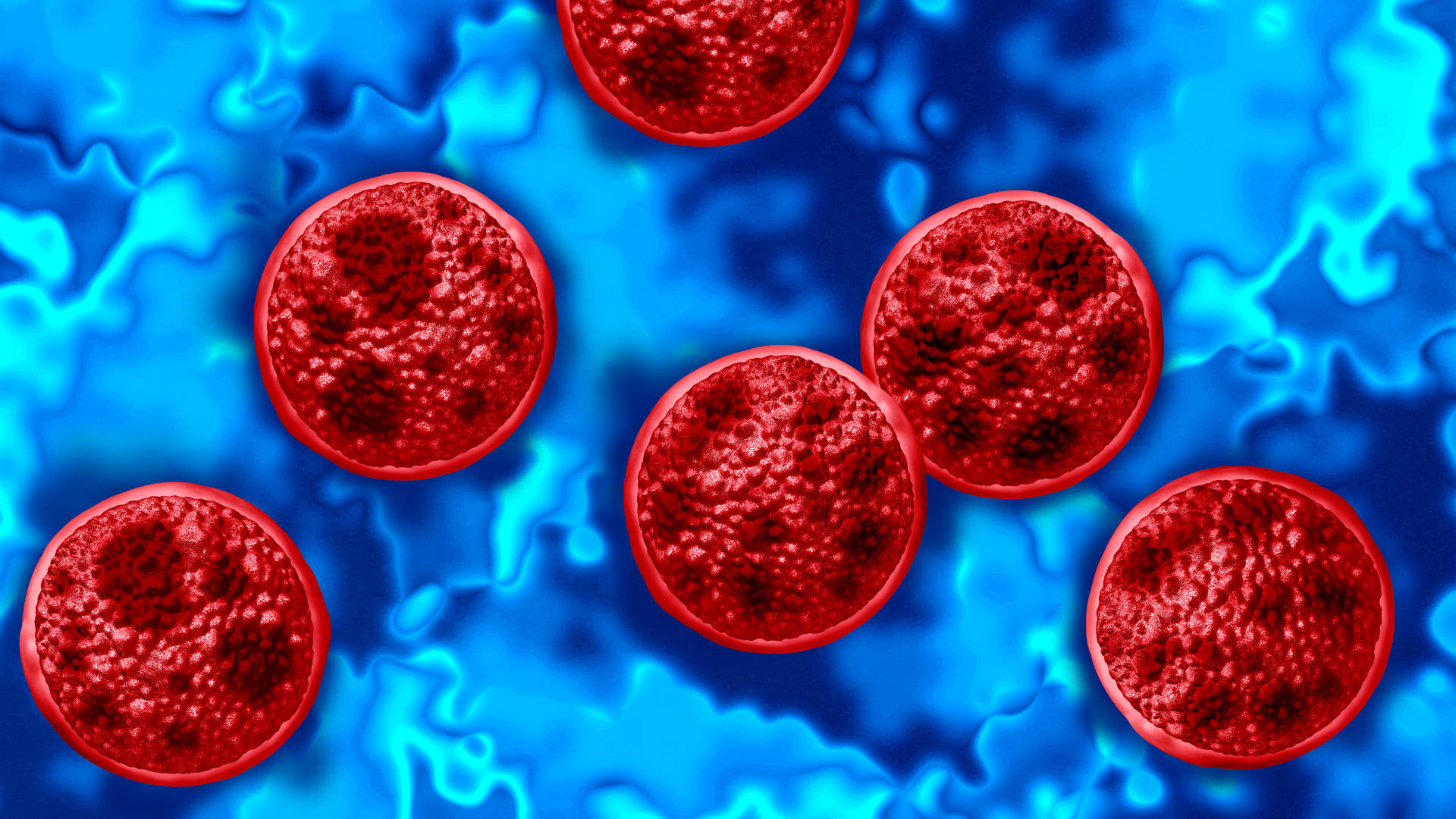 Michigan confirms first two deaths in cyclospora outbreak