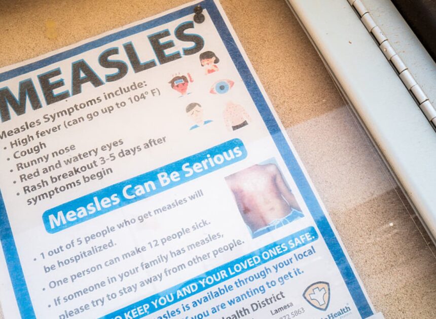 A ‘canary in the coal mine’: Measles resurgence exposes weaknesses in U.S. public health, experts say
