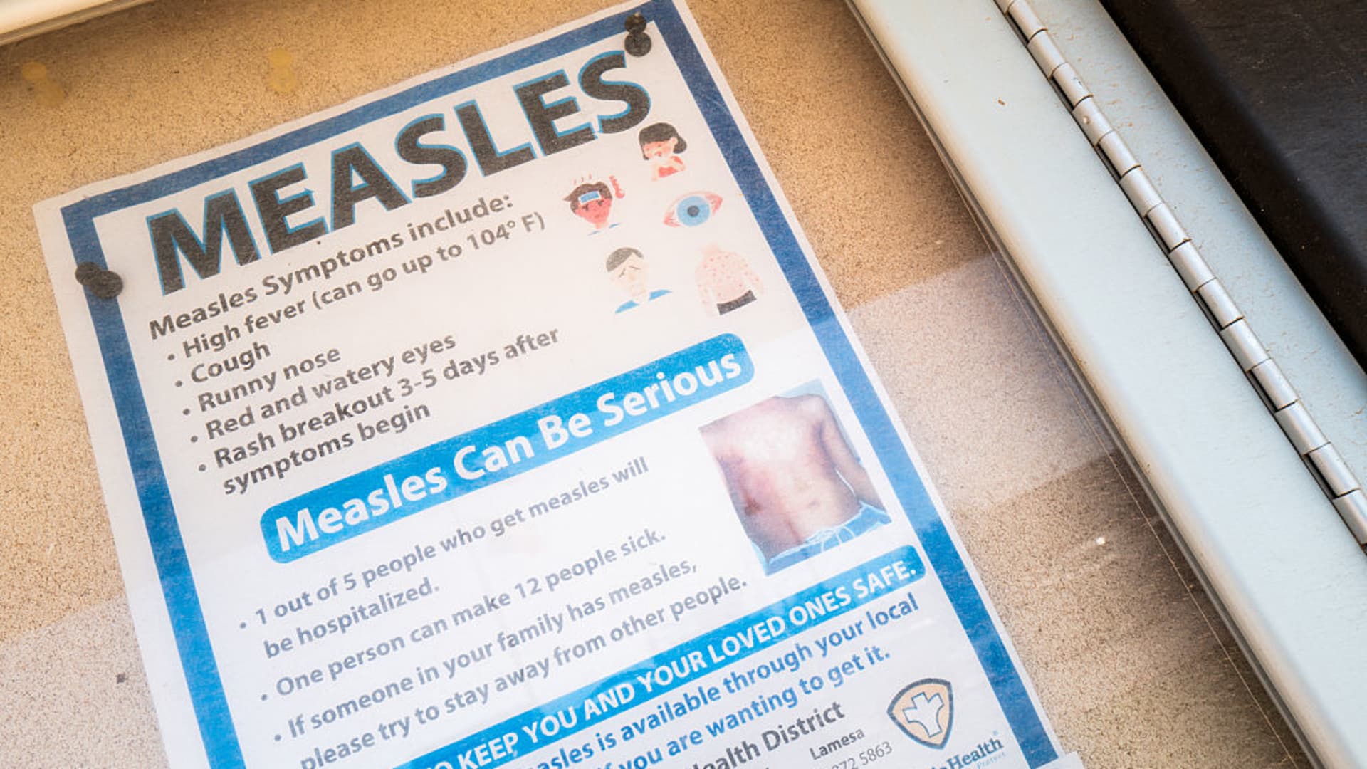 A ‘canary in the coal mine’: Measles resurgence exposes weaknesses in U.S. public health, experts say